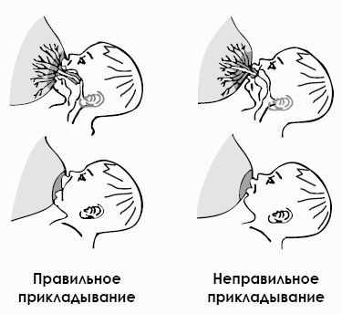 Проилактика и псев.