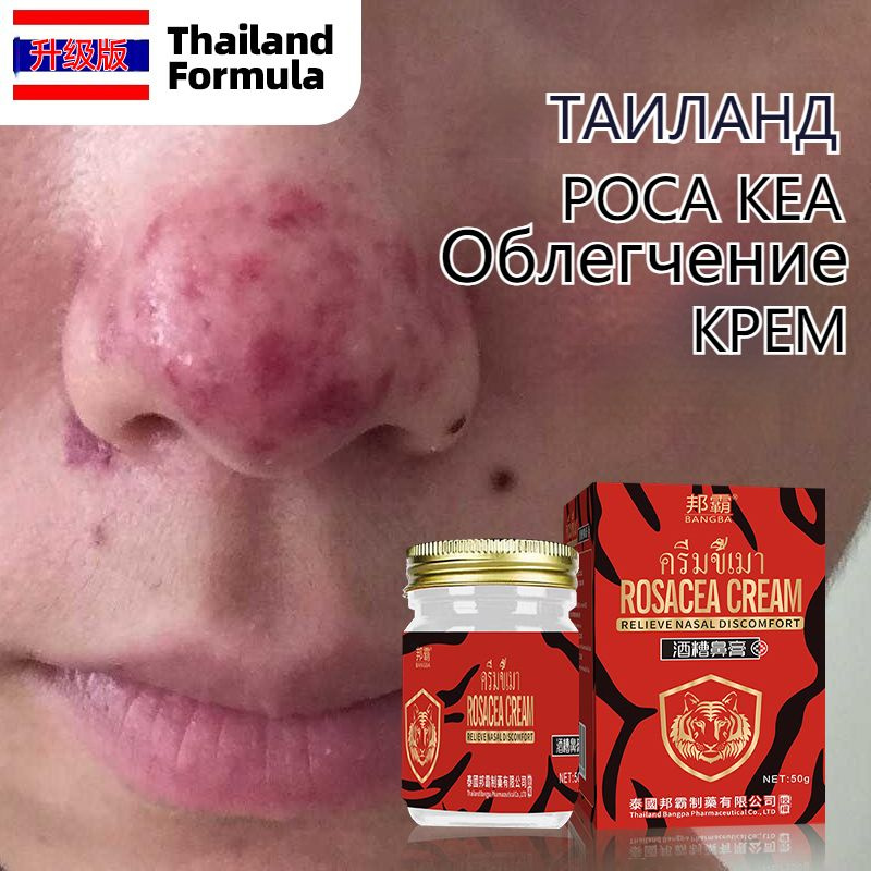 Крэм oT -kuperoзa yroзea otpocracneneniй и raзdraжeniй nankoжe, 50 ...