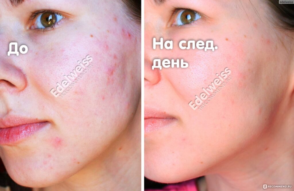 Germatrotropnhe sreDSTVA Pfizer DALAцINGELAH
